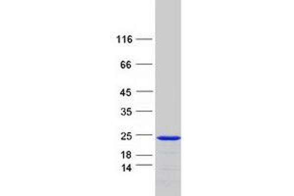 SNX12 Protein (Myc-DYKDDDDK Tag)