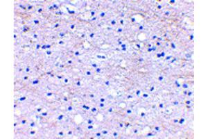 Immunohistochemistry of BRAL1 Antibody Immunohistochemistry of BRAL1 antibody. (HAPLN2 Antikörper  (Internal Region))