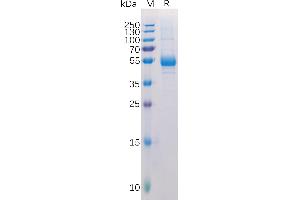 Human TN Protein, hFc Tag on SDS-PAGE under reducing condition. (RANKL Protein (Fc Tag))