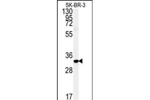 Western blot analysis of FA1 Antibody (Center) (ABIN651364 and ABIN2840202) in SK-BR-3 cell line lysates (35 μg/lane). (FAM92A1 Antikörper  (AA 113-141))