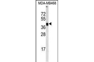 Western blot analysis of LOX Antibody (Center) (ABIN653071 and ABIN2842672) in MDA-M cell line lysates (35 μg/lane). (LOX Antikörper  (AA 234-260))
