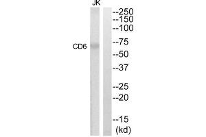 Western Blotting (WB) image for anti-CD6 (CD6) (Internal Region) antibody (ABIN1852261) (CD6 Antikörper  (Internal Region))