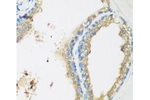 Immunohistochemistry of paraffin-embedded Human prostate using WDR77 Polyclonal Antibody at dilution of 1:200 (40x lens). (WDR77 Antikörper)