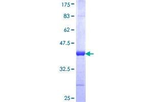 JARID2 Protein (AA 1130-1229) (GST tag)