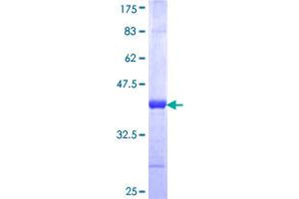 JARID2 Protein (AA 1130-1229) (GST tag)