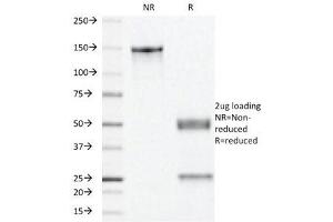 SDS-PAGE Analysis of Purified, BSA-Free Progesterone Receptor Antibody (clone PR501). (Progesterone Receptor Antikörper)