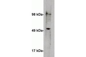 Western blot on human kidney lysate (10 ug/lane) using  anti Serine palmitoyltransferase 1 antibody (cat X2066P) at 1 ug/ml. (SPTLC1 Antikörper)