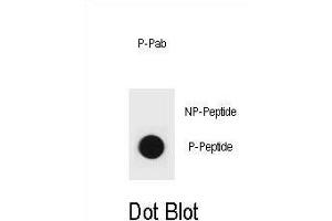 Dot blot analysis of PTEN Antibody (Phospho ) Phospho-specific Pab (ABIN6241056 and ABIN6578943) on nitrocellulose membrane. (PTEN Antikörper  (pTyr315))