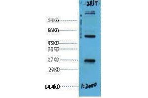 Western Blotting (WB) image for anti-EF-Hand Domain Family, Member D1 (EFHD1) antibody (ABIN3181263) (EFHD1 Antikörper)