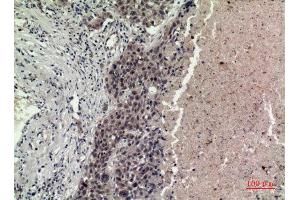 Immunohistochemistry (IHC) analysis of paraffin-embedded Human Lung, antibody was diluted at 1:100. (FGF16 Antikörper  (Internal Region))