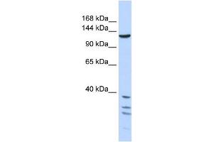 TNKS antibody used at 1 ug/ml to detect target protein. (TNKS Antikörper  (Middle Region))