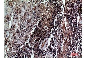 Immunohistochemistry (IHC) image for anti-CD84 (CD84) (Internal Region) antibody (ABIN3187786)