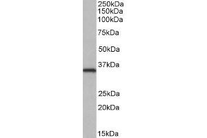Western Blotting (WB) image for anti-NEK7 (NEK7) antibody (ABIN5925874) (NEK7 Antikörper)