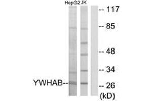 Western Blotting (WB) image for anti-14-3-3 alpha + beta (YWHAB) (AA 41-90) antibody (ABIN2889837) (YWHAB Antikörper  (AA 41-90))