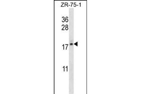 TNP2 Antikörper  (C-Term)