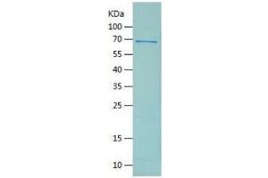 SDS-PAGE 70. (GFAP Protein (AA 1-430) (His-IF2DI Tag))