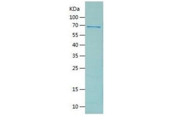 GFAP Protein (AA 1-430) (His-IF2DI Tag)