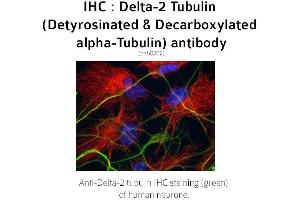 Image no. 2 for anti-Tubulin delta 2 (C-Term) antibody (ABIN489937) (Tubulin delta 2 (C-Term) Antikörper)