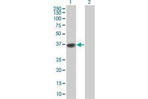 Lane 1: BOLL transfected lysate ( 32. (BOLL 293T Cell Transient Overexpression Lysate(Denatured))