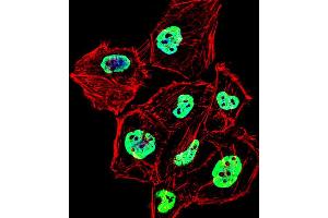 Fluorescent confocal image of Hela cell stained with HNRNPD Antibody (N-term). (HNRNPD/AUF1 Antikörper  (N-Term))