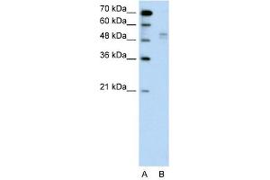 WWP2 antibody used at 1 ug/ml to detect target protein. (WWP2 Antikörper  (Middle Region))