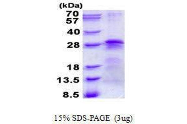 BTF3 Protein