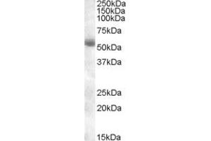 Image no. 1 for anti-Transmembrane Protease, serine 2 (TMPRSS2) (AA 518-529) antibody (ABIN342990) (TMPRSS2 Antikörper  (AA 518-529))