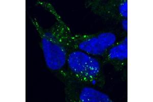 Immunofluorescence (IF) image for anti-Vacuolar Protein Sorting 35 (VPS35) antibody (ABIN5906217) (VPS35 Antikörper)