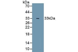 Detection of Recombinant ZFHX1B, Mouse using Polyclonal Antibody to Zinc Finger Homeobox Protein 1B (ZFHX1B) (ZEB2 Antikörper  (AA 962-1215))