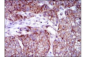 Immunohistochemistry (IHC) image for anti-Zinc Finger Protein 42 (ZFP42) (AA 249-310) antibody (ABIN1724849)