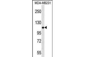 ACTN3 Antibody (Center) (ABIN656261 and ABIN2845575) western blot analysis in MDA-M cell line lysates (35 μg/lane). (ACTN3 Antikörper  (AA 409-437))
