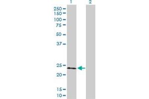 Western Blot analysis of TIMP2 expression in transfected 293T cell line by TIMP2 MaxPab polyclonal antibody. (TIMP2 Antikörper  (AA 1-220))