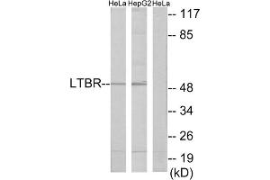 Western blot analysis of extracts from HeLa cells and HepG2 cells, using LTBR antibody. (LTBR Antikörper  (N-Term))