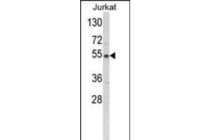 Western blot analysis of BCKDHA Antibody (C-term) (ABIN390811 and ABIN2841048) in Jurkat cell line lysates (35 μg/lane). (BCKDHA Antikörper  (C-Term))