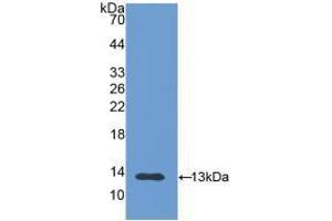 Western blot analysis of recombinant Human PIGR. (PIGR Antikörper  (AA 19-120))