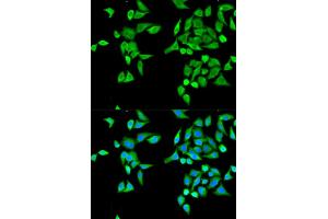 Immunofluorescence analysis of MCF-7 cells using CES2 antibody (ABIN5970708). (CES2 Antikörper)