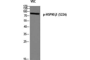 Western Blot (WB) analysis of VEC using p-HSP90beta (S226) antibody. (HSP90AB1 Antikörper  (pSer226))