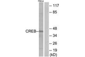 Western blot analysis of extracts from HeLa cells, treated with UV 15', using CREB (Ab-129) Antibody. (CREB1 Antikörper  (AA 96-145))