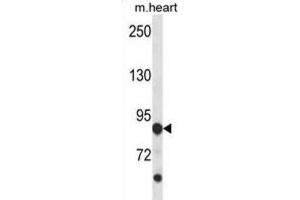 Western Blotting (WB) image for anti-Cyclin-Dependent Kinase-Like 5 (CDKL5) antibody (ABIN2998465) (CDKL5 Antikörper)