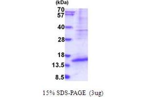 DPPA5 Protein (AA 1-116) (His tag)