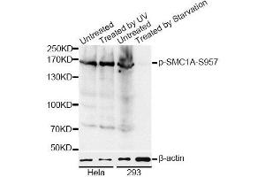 Western blot analysis of extracts of HeLa and 293 cells, using Phospho-SMC1A-S957 antibody (ABIN5969934) at 1/1000 dilution. (SMC1A Antikörper  (pSer957))