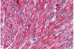 Human Uterus, Smooth Muscle (formalin-fixed, paraffin-embedded) stained with CD44 antibody ABIN239810 at 10 ug/ml followed by biotinylated anti-mouse IgG secondary antibody ABIN481714, alkaline phosphatase-streptavidin and chromogen. (CD44 Antikörper)