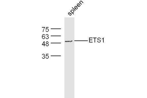 ETS1 Antikörper  (AA 321-441)