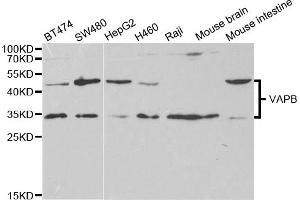 Western blot analysis of extracts of various cell lines, using VAPB antibody. (VAPB Antikörper)