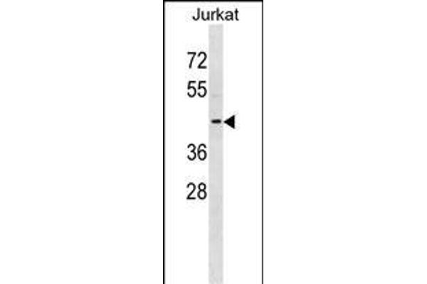 KCNAB3 Antikörper  (AA 176-204)