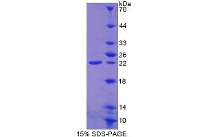 SDS-PAGE analysis of Mouse FTH Protein. (Ferritin, Heavy Polypeptide 1 (FTH1) Peptid)