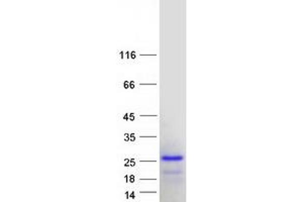 C1orf144 Protein (Transcript Variant 1) (Myc-DYKDDDDK Tag)