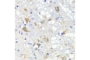 Immunohistochemistry of paraffin-embedded rat brain using PSPH antibody. (PSPH Antikörper  (AA 1-225))