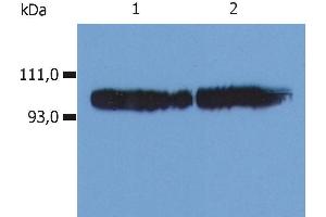 Western Blotting (WB) image for anti-Integrin beta 2 (ITGB2) antibody (ABIN94005)