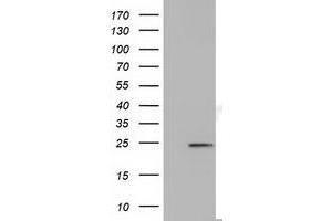 HEK293T cells were transfected with the pCMV6-ENTRY control (Left lane) or pCMV6-ENTRY MOBKL2B (Right lane) cDNA for 48 hrs and lysed. (MOBKL2B Antikörper)